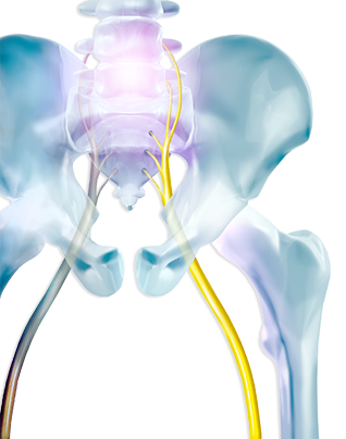 sciatica-treatment-south-florida